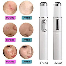 Load image into Gallery viewer, Advanced Skin Spots Removal Pen (Blue Light™ Technology)