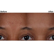 Load image into Gallery viewer, Porevac™ Facial Pore Cleanser