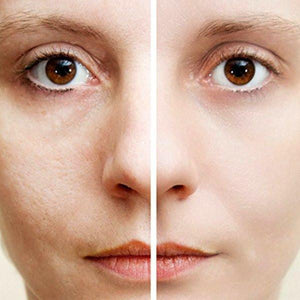 Porevac™ Facial Pore Cleanser