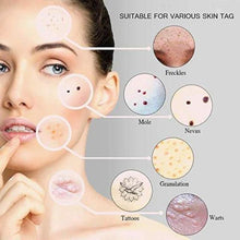 Load image into Gallery viewer, Advanced Skin Spots Removal Pen (Blue Light™ Technology)